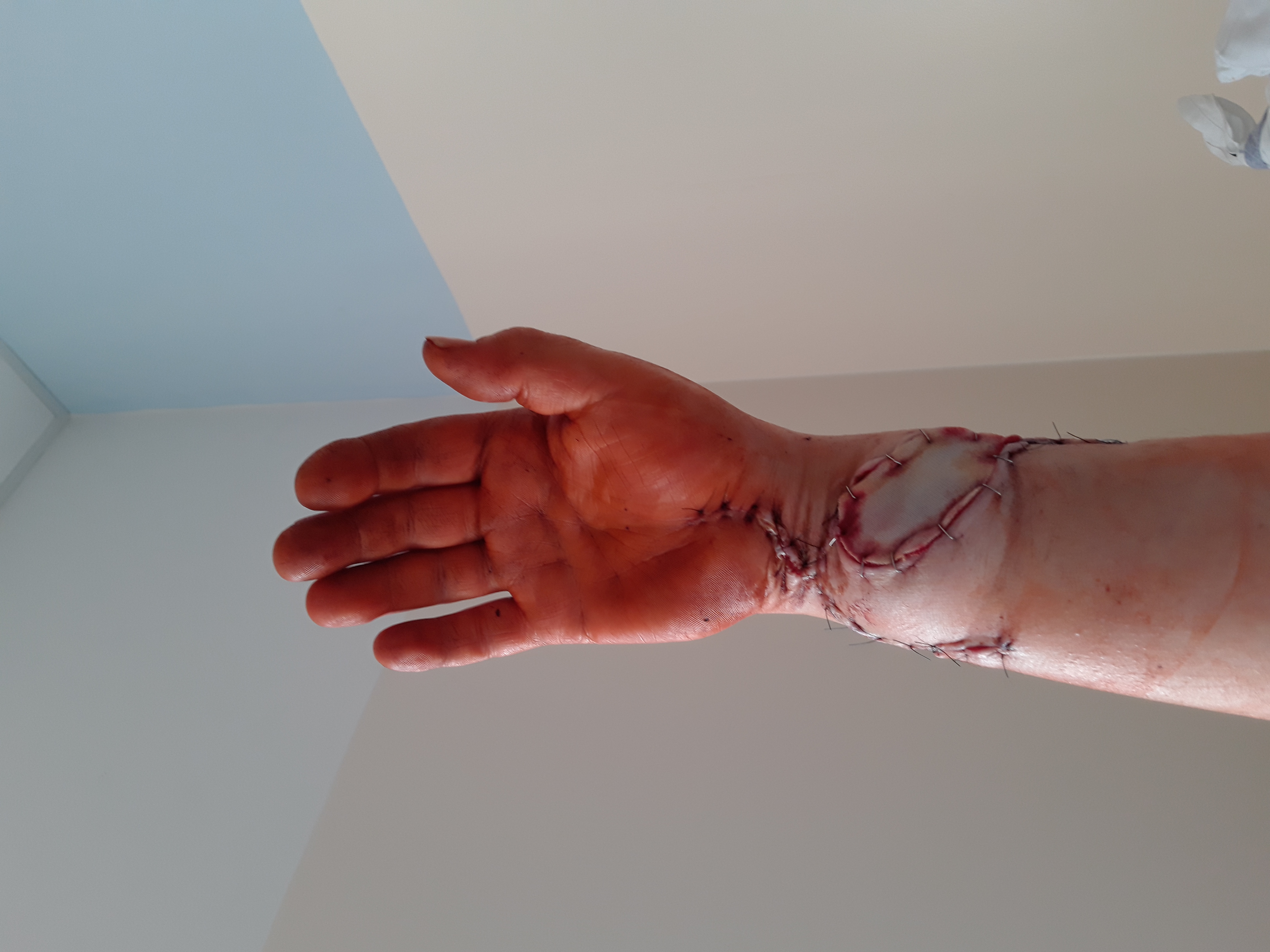 Chirurgické oddělení - Nemocnice České Budějovice foto 2