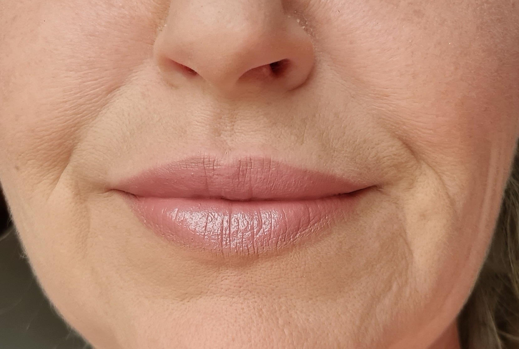 E&E clinic - Oční a estetická klinika (MUDr. Ivana Kundrátová) foto 2