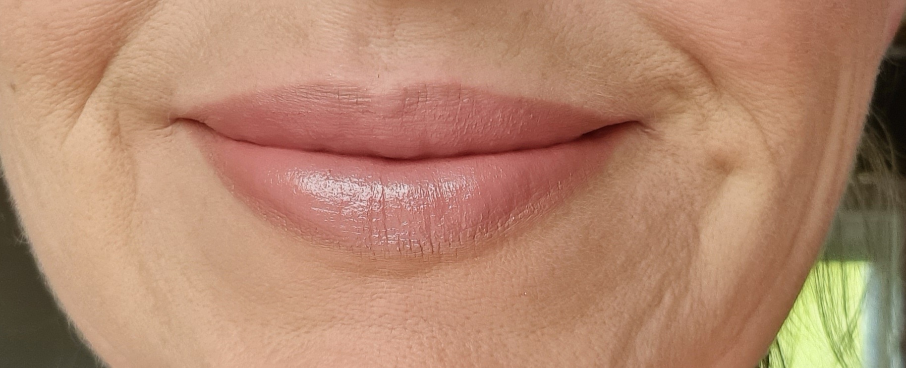 E&E clinic - Oční a estetická klinika (MUDr. Ivana Kundrátová) foto 3