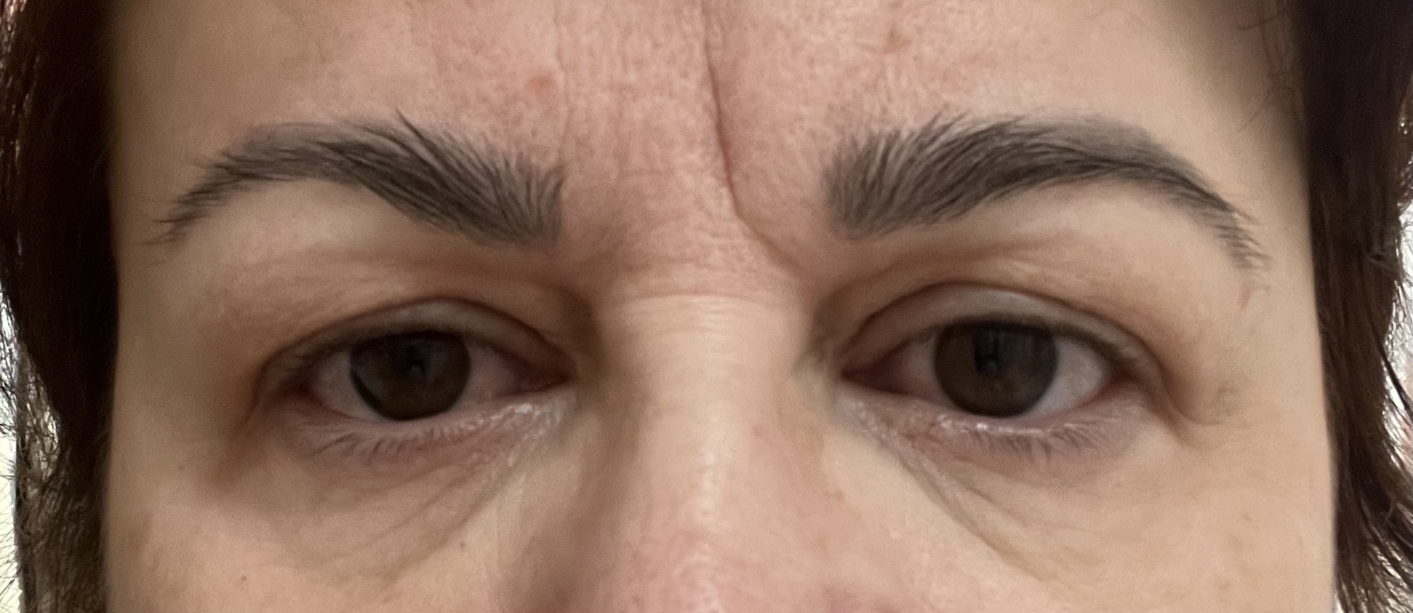 Plastický chirurg - MUDr. Evžen Trupar, Ph.D. foto 6