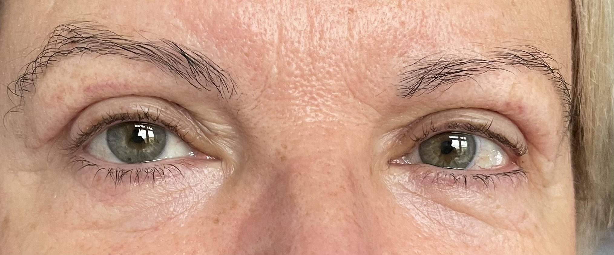 Plastický chirurg - MUDr. Evžen Trupar, Ph.D. foto 5