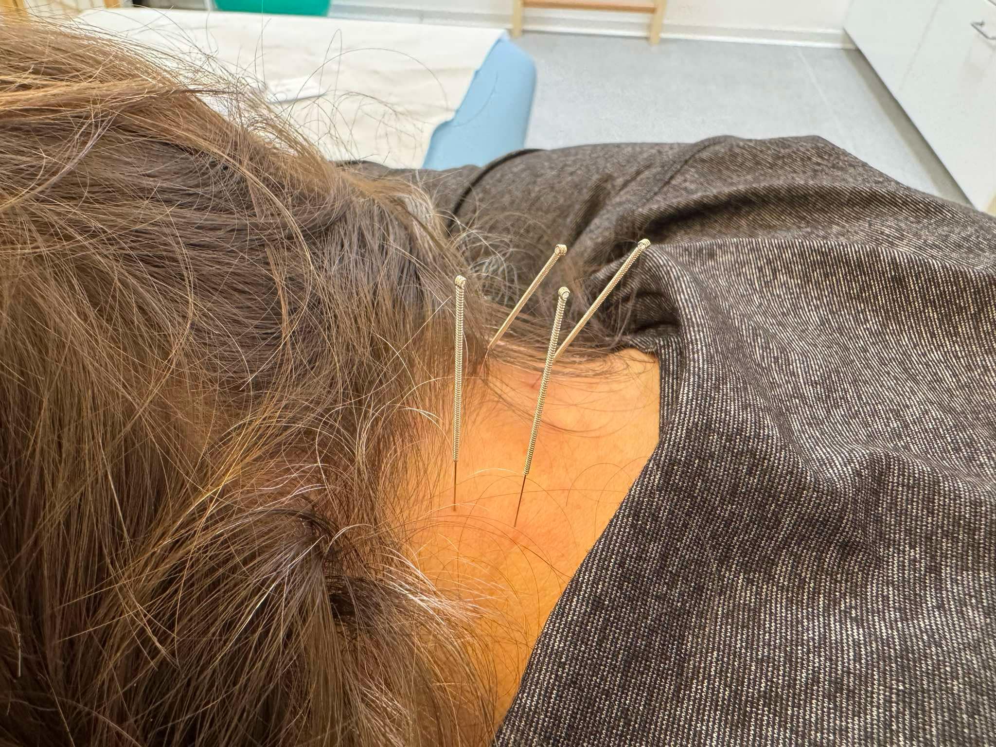 SinoFyzio a Tradiční čínská medicína, TČM - Bc. Xin Wen foto 4