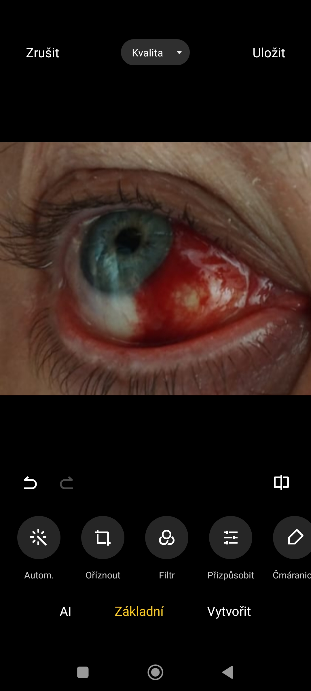 Všeobecná oční ambulance - Nemocnice České Budějovice foto 2