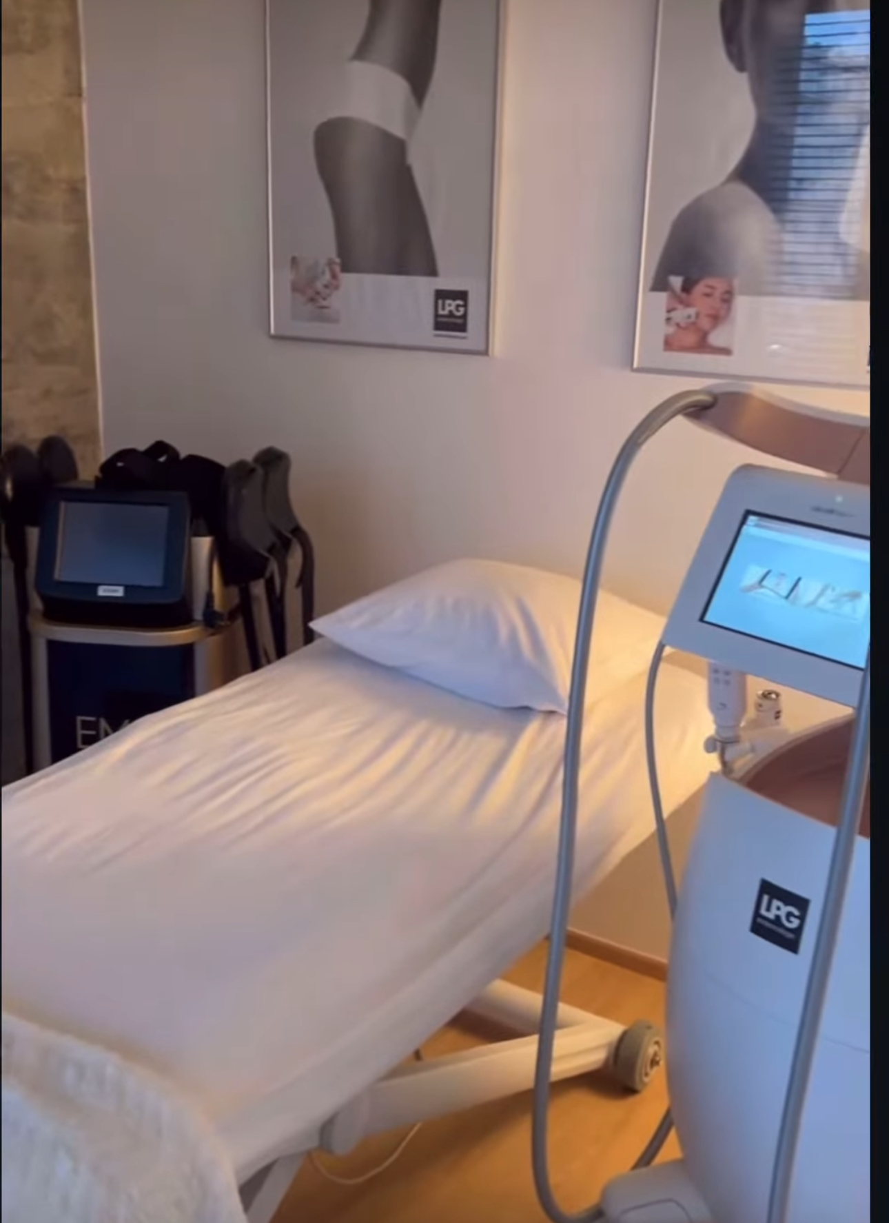 Zeštíhlení Polanská foto 2