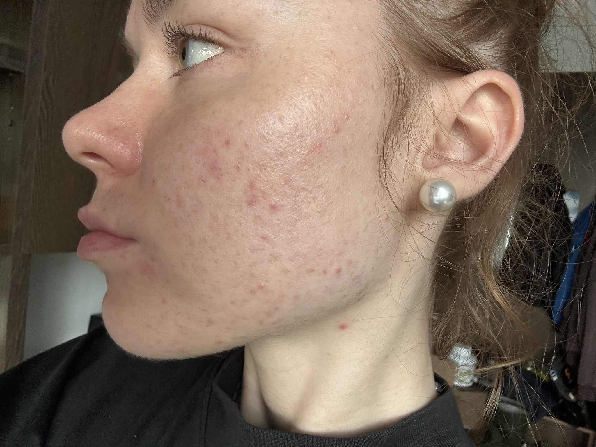 Altea centrum - Biorezonance BICOM a celostní medicína foto 6