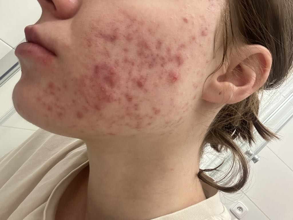 Altea centrum - Biorezonance BICOM a celostní medicína foto 5