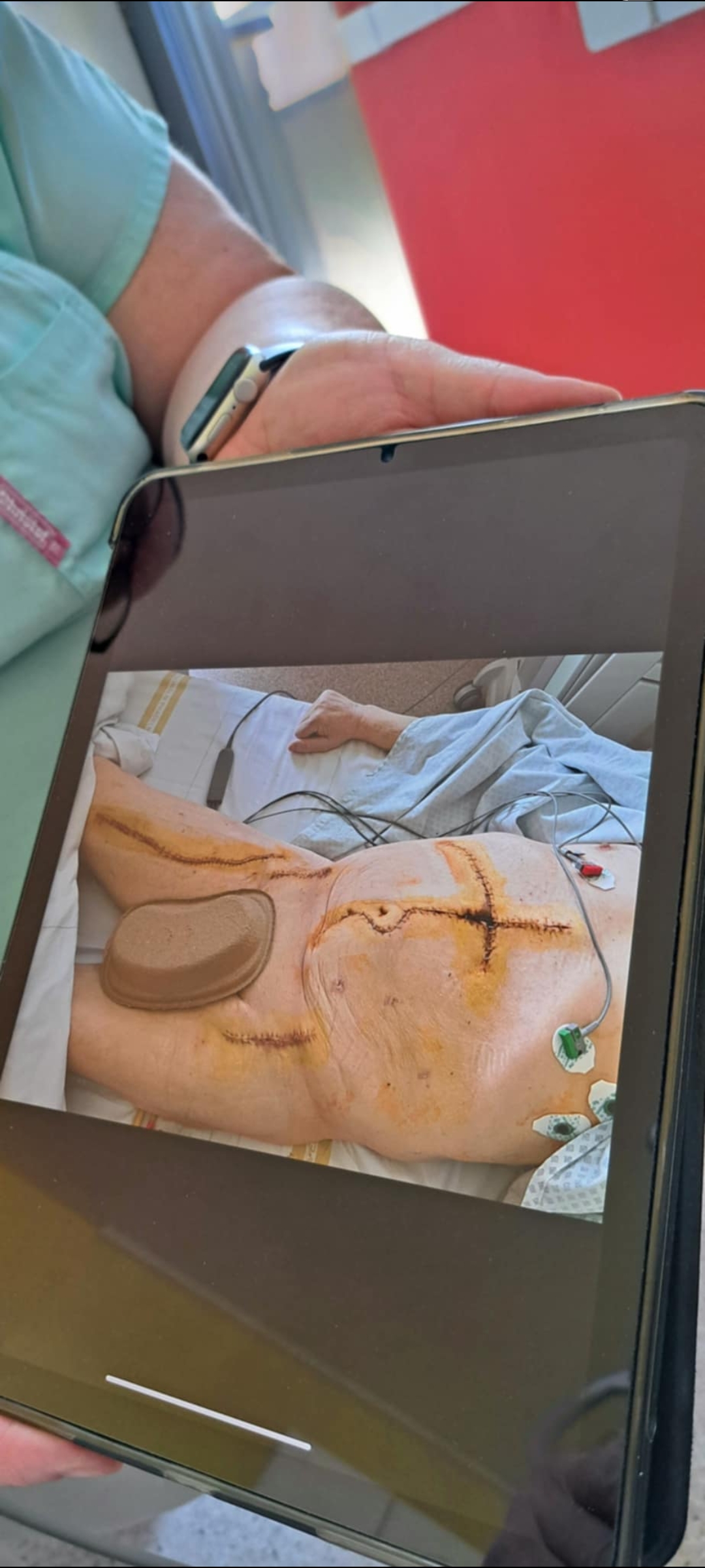 Cévní chirurgie - FNMH, pracoviště Homolka foto 2