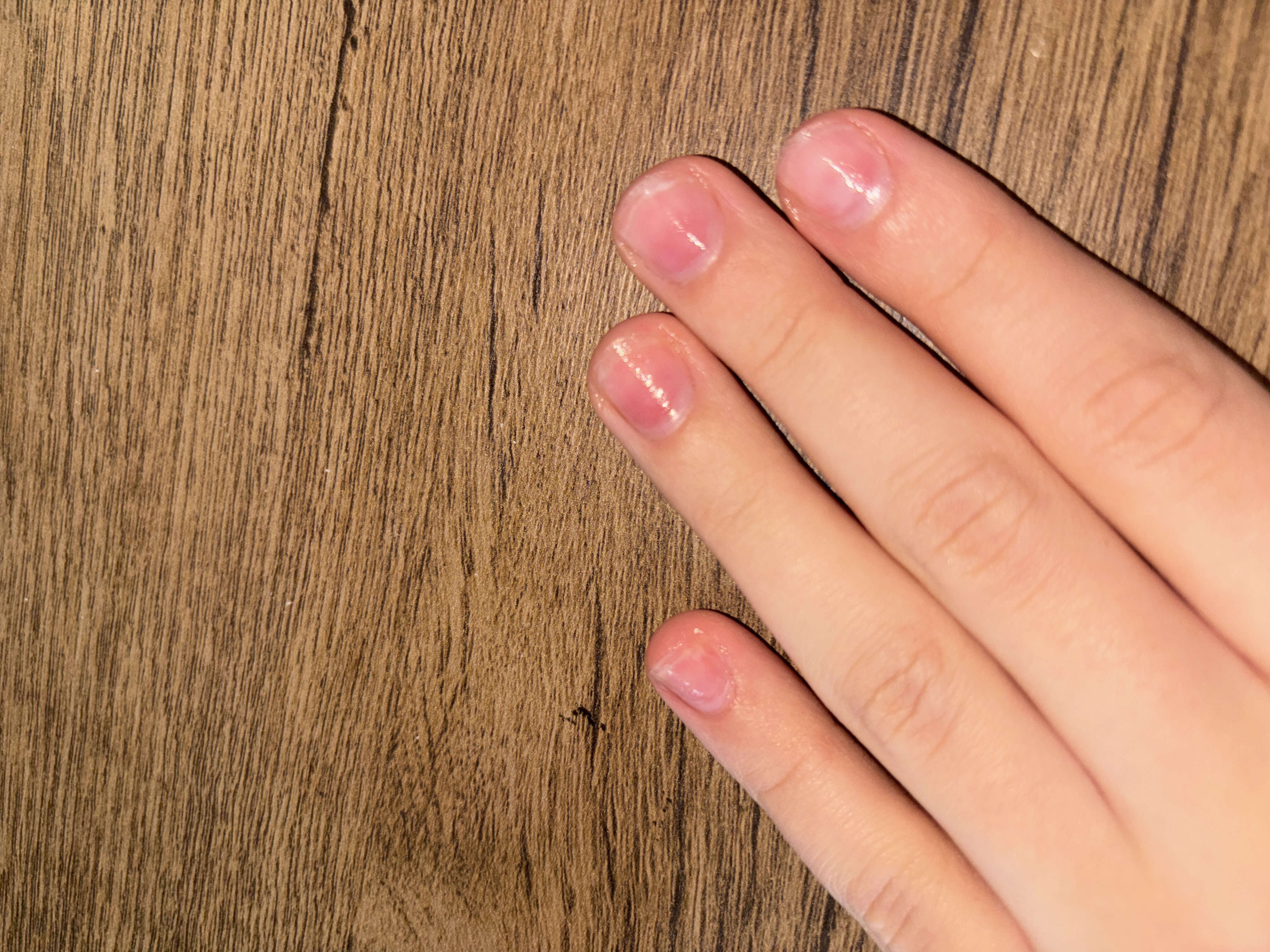 Infinity Nail Salon foto 1
