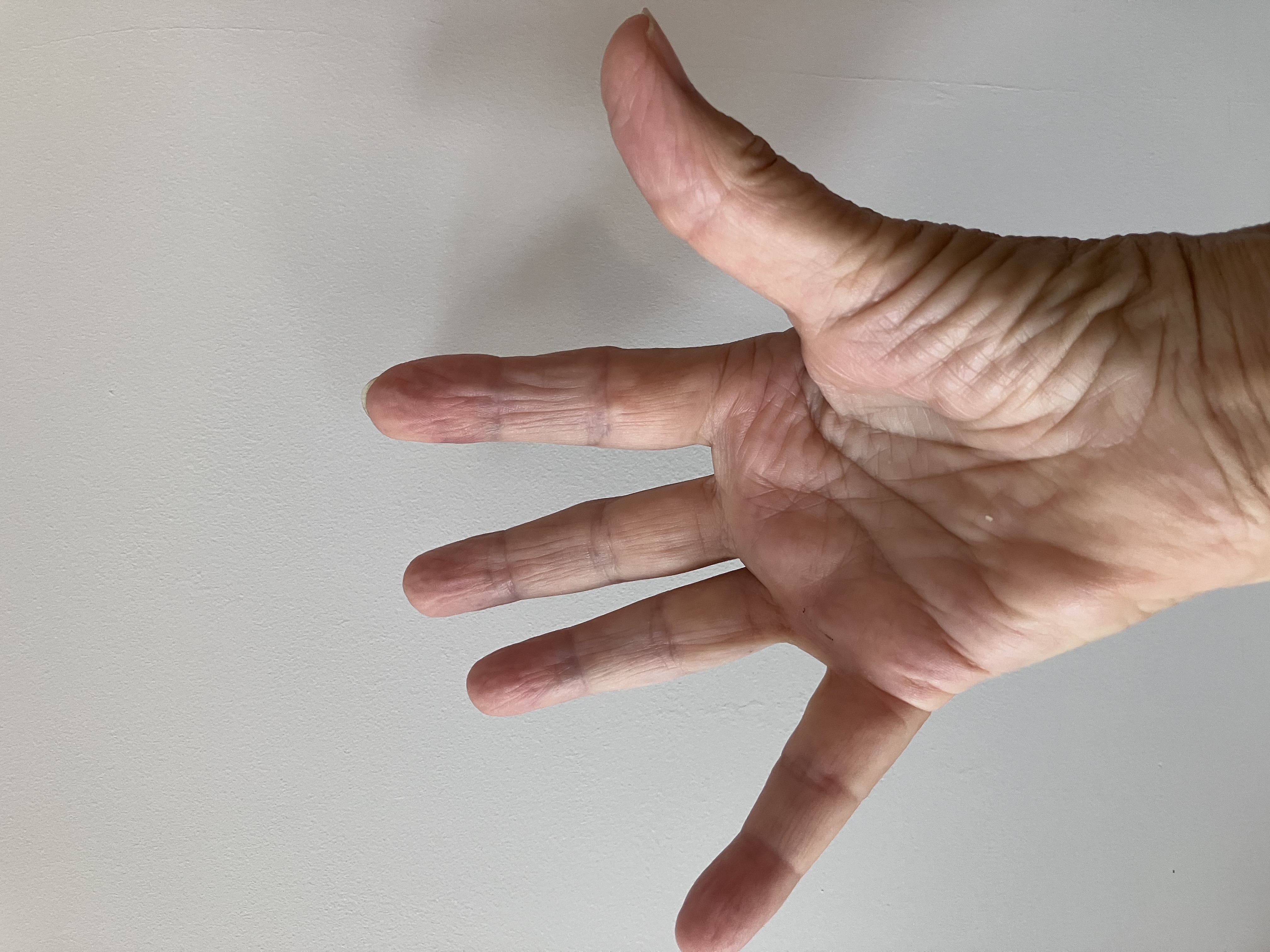 neuroendo foto 4